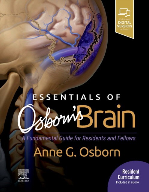 Essentials of osborn`s brain Essentials of osborn`s brain