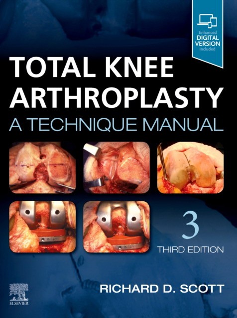 Total Knee Arthroplasty