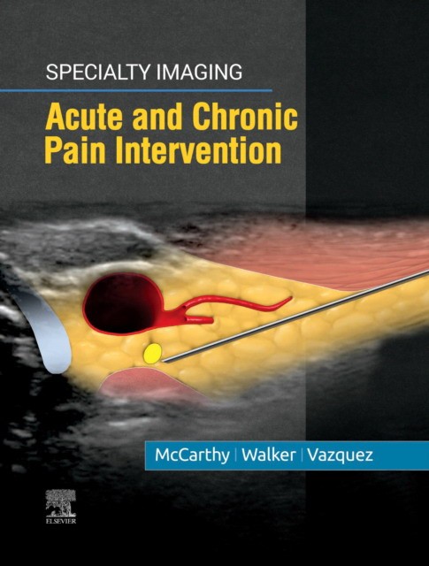 Specialty Imaging: Acute and Chronic Pain Intervention