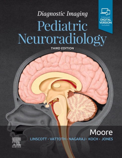 Diagnostic Imaging: Pediatric Neuroradiology, 3rd Edition