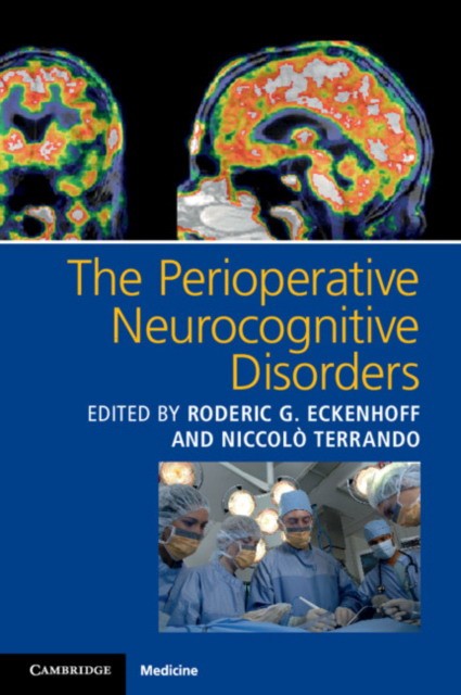 The Perioperative Neurocognitive Disorders