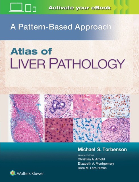 Atlas of Liver Pathology: A Pattern-Based Approach Atlas of Liver Pathology: A Pattern-Based Approach