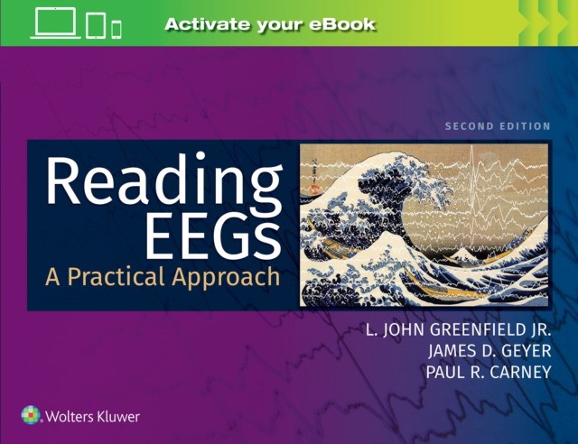 Reading EEGs: A Practical Approach, 2 ed