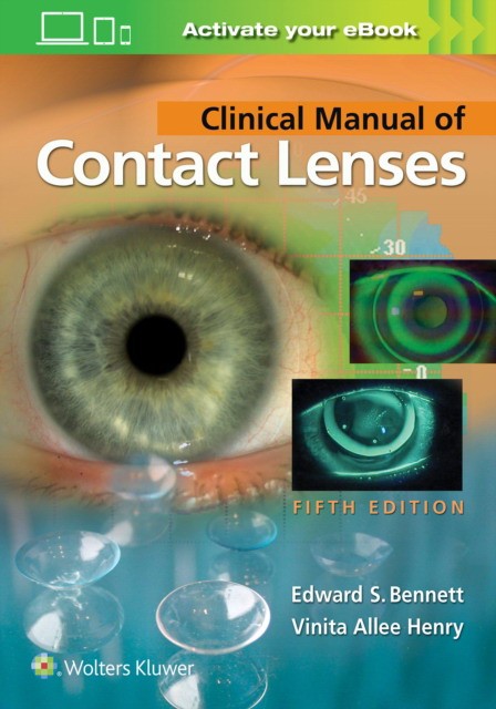 Clinical Manual Of Contact Lenses 5E Pb