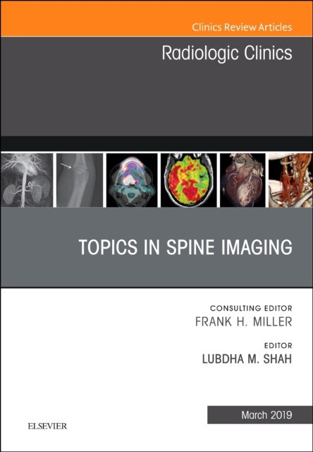 Topics in Spine Imaging, An Issue of Radiologic Clinics of North America,57-2