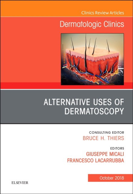 Alternative Uses of Dermatoscopy, An Issue of Dermatologic Clinics,36-4