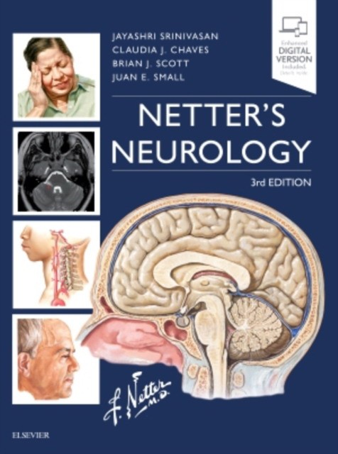 Netter's Neurology, 3 ed.
