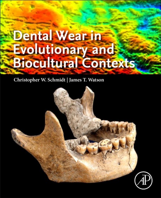 Schmidt-Dental Wear in Evolutionary and Biocultural Contexts