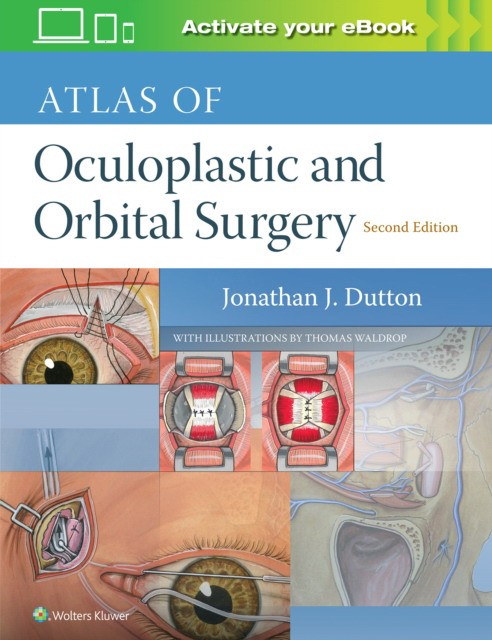 Atlas of oculoplastic and orbital surgery