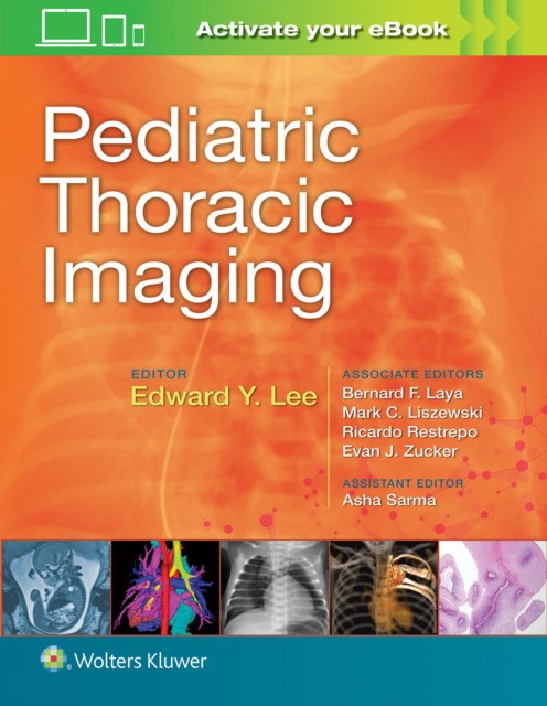 Pediatric thoracic imaging