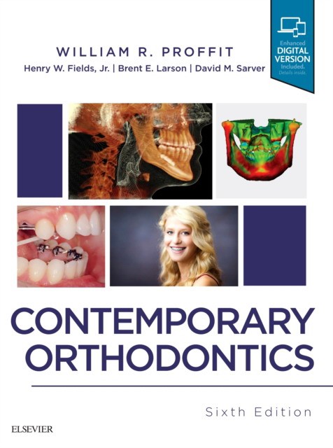 Contemporary orthodontics.- Elsevier Science,  2018