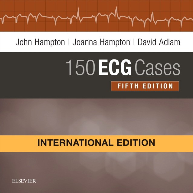 150 150 обложка. John Hampton ECG. John Hampton 150 проблем. Third Edition 150 problems John r Hampton www Churchill Livingstone.