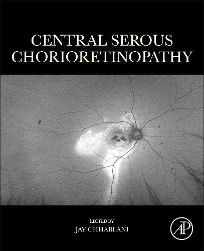 Central Serous Chorioretinopathy