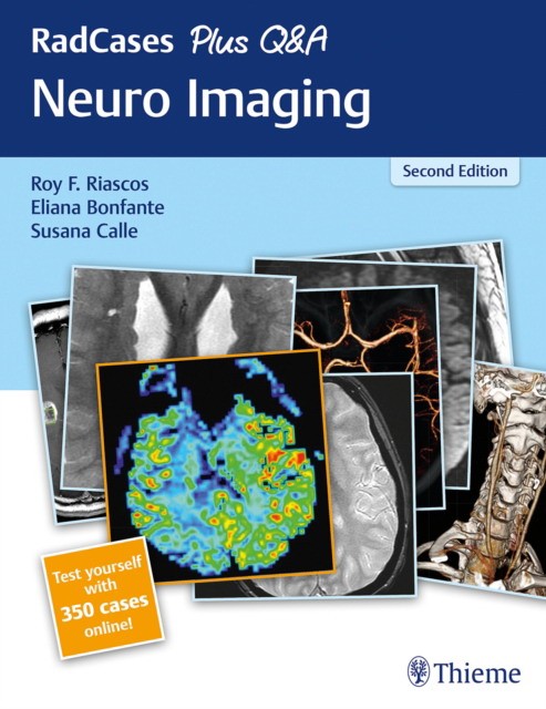 Radcases Plus Q&a: Neuro Imaging