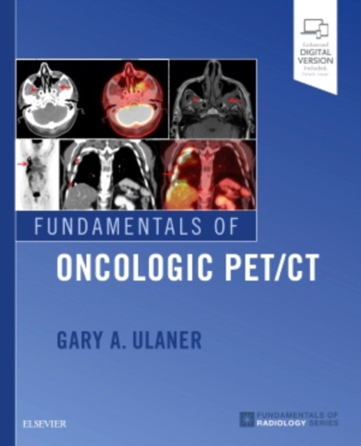 Fundamentals of oncologic pet/ct