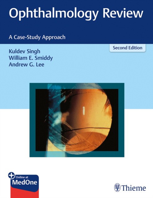 Ophthalmology Review: A Case-Study Approach