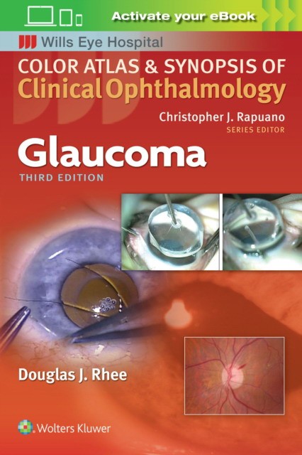 Glaucoma color atlas ophth 3e