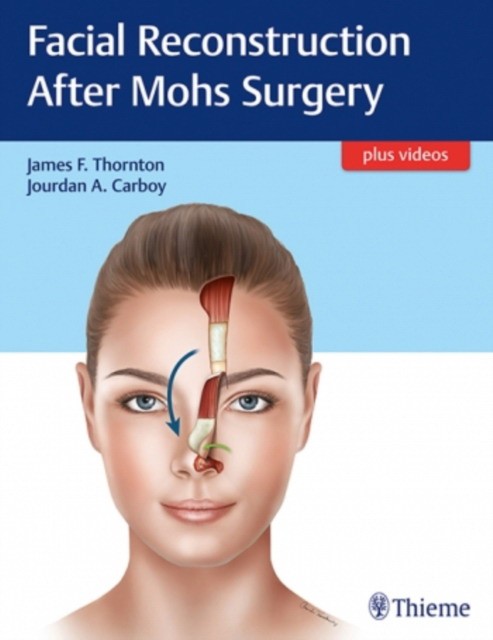 Facial reconstruction after mohs surgery