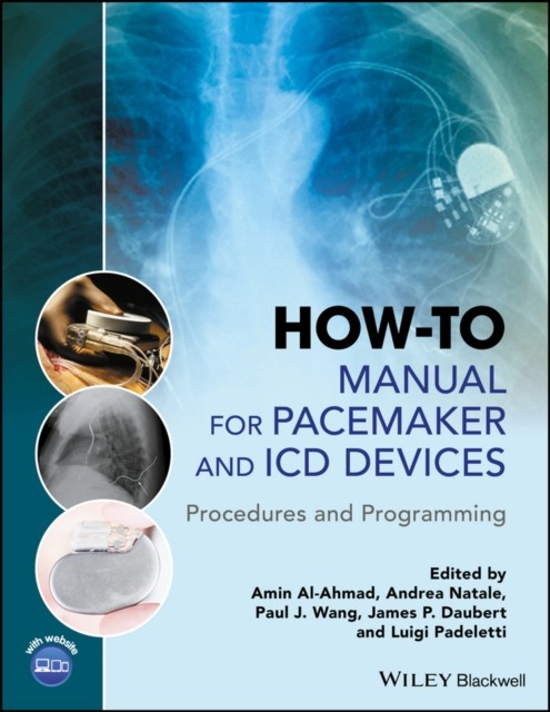 How-to Manual for Pacemaker and ICD Devices: Procedures and Programming