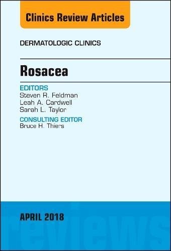 Rosacea, An Issue of Dermatologic Clinics,36-2