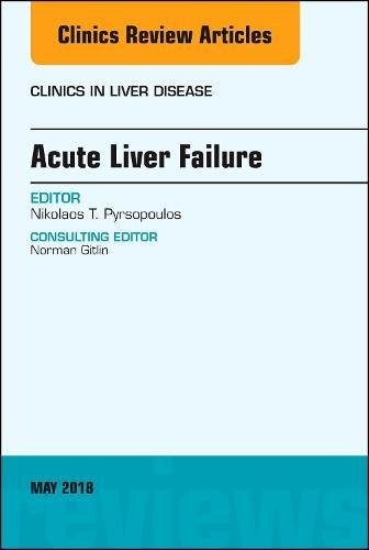 Acute Liver Failure, An Issue of Clinics in Liver Disease,22-2