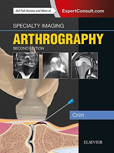Specialty Imaging: Arthrography