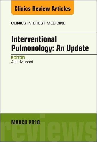 Interventional Pulmonology, An Issue of Clinics in Chest Medicine,39-1