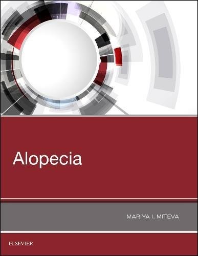 Alopecia