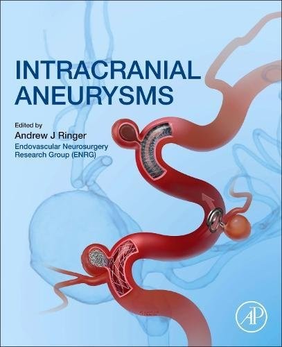 Intracranial Aneurysms Intracranial Aneurysms