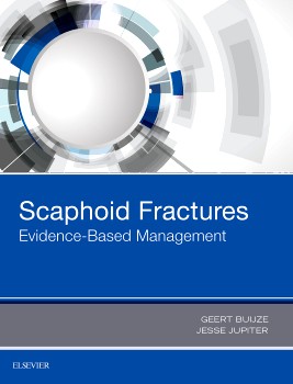 Scaphoid Fractures Scaphoid Fractures