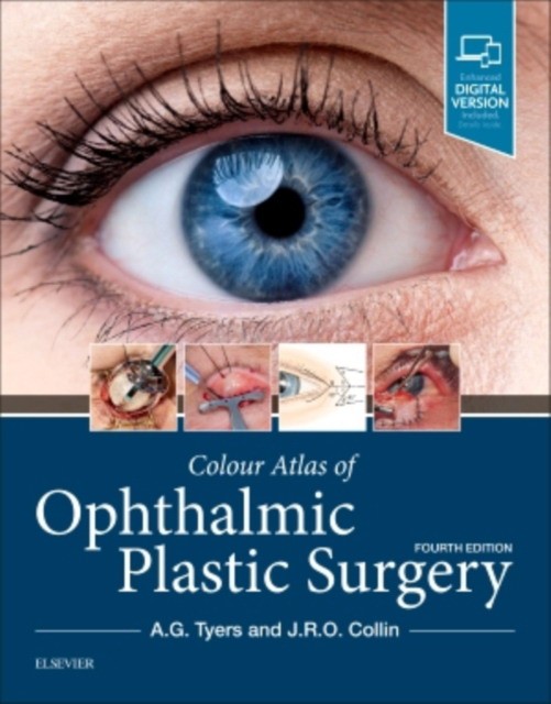 Colour Atlas of Ophthalmic Plastic Surgery, 4th Edition