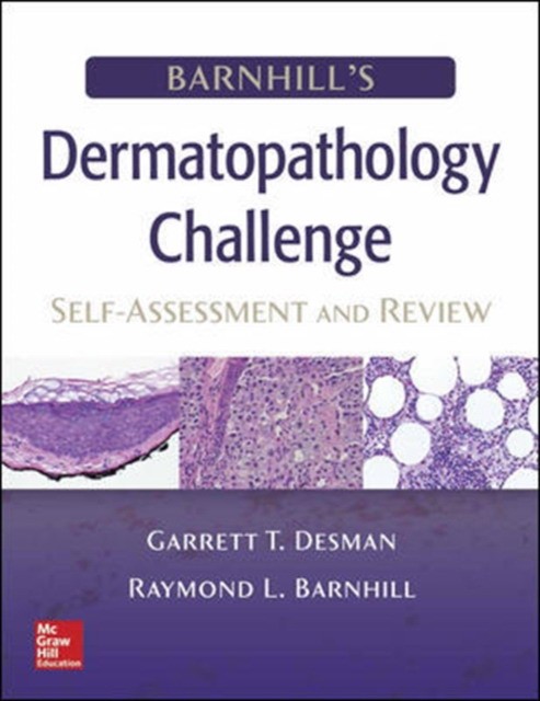 Barnhill'S Dermatopathology Challenge: Self-Assessment & Review