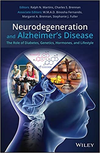 Food Composition, Diet and Alzheimer's Disease: Th e state of the art and promising therapeutic agent s