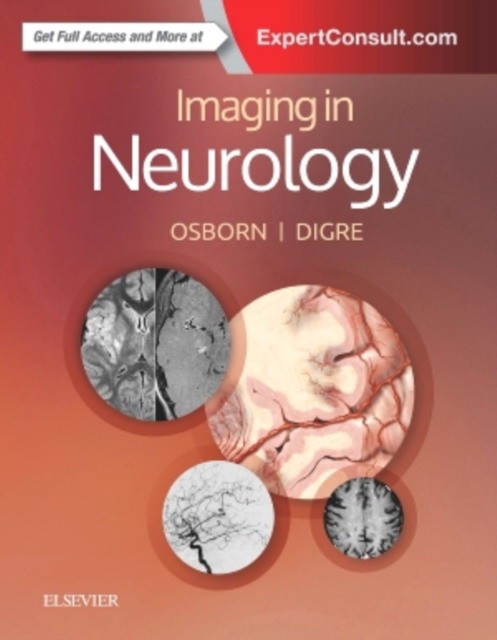 Imaging in Neurology, 1e