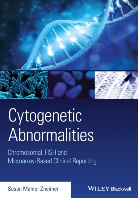 Cytogenetic Abnormalities: Chromosomal, FISH, and Microarray-Based Clinical Reporting and Interpretation of Result