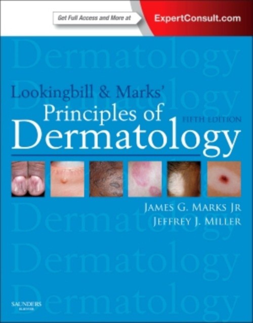 Lookingbill and Marks' Principles of Dermatology,