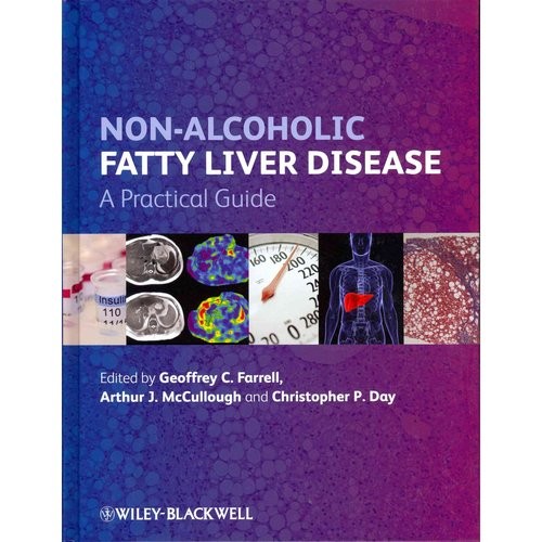 Non-Alcoholic Fatty Liver Disease: A Practical Guide