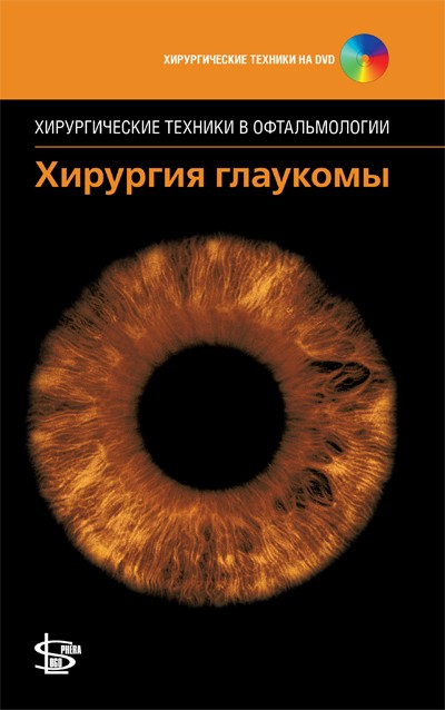 Хирургия глаукомы + DVD (серия Хирургические техники в офтальмологии )