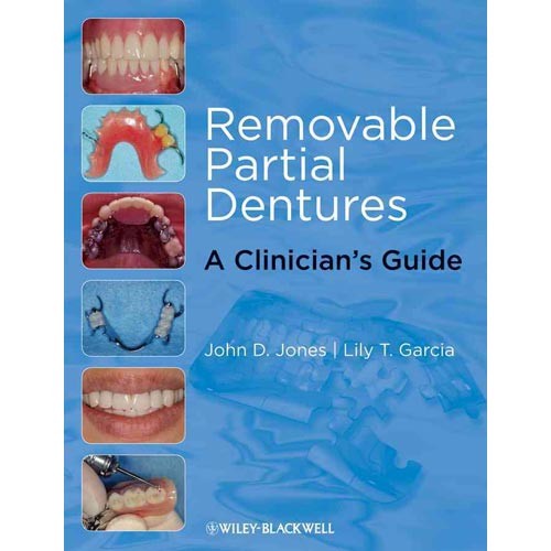 Removable Partial Dentures: A Clinician's Guide.- Wiley, 2009