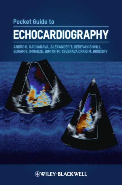 Pocket Guide to Echocardiography