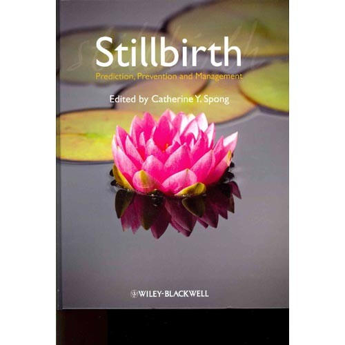 Stillbirth: Prediction, Prevention and Management