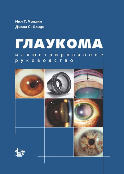Глаукома: иллюстрированное руководство