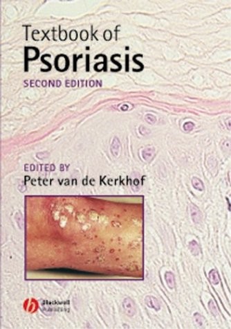 TB of Psoriasis.2003