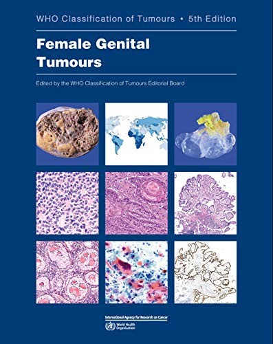 WHO Classification of Tumours: Female Genital Tumours. 5 Ed.