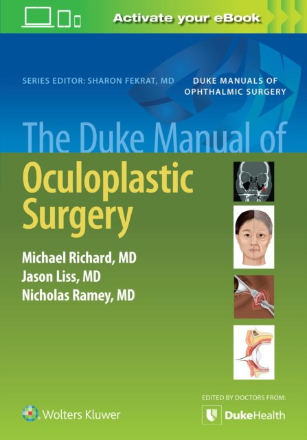 Duke Manual Oculoplastic Surgery