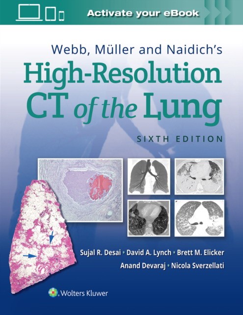 High-Resolution Ct Of The Lung 6E High-Resolution Ct Of The Lung 6E
