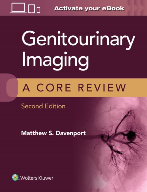 Genitourinary Imaging Core Review 2E