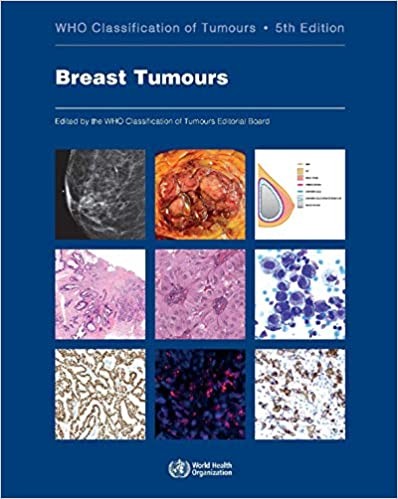 WHO Classification of Breast Tumours. 5 Ed