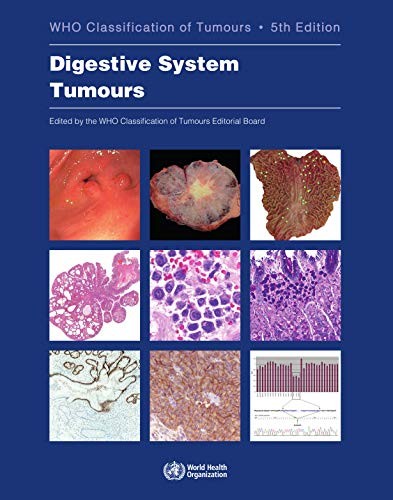 Who Classification of Digestive System Tumours. 5 ed