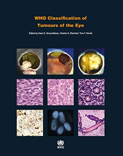 WHO Classification of Tumours of the Eye .4 Ed